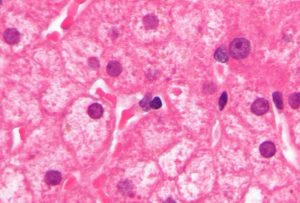 Lipofuszin