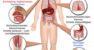 Fibromyalgie Symptome Grafik