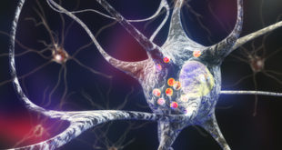 Parkinson 3D illustration
